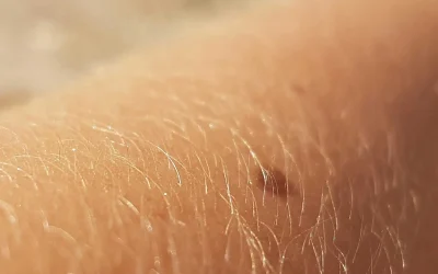 Miért a skin longevity a jövő?